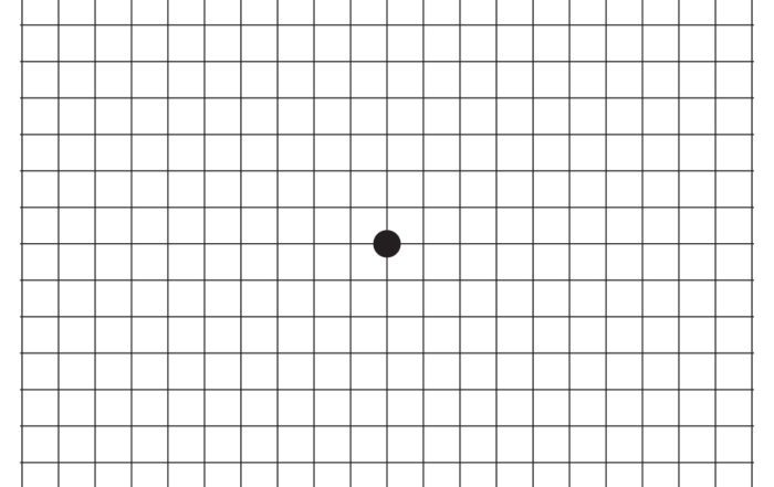 Amsler Grid with grid lines to test for vision abnormalities.