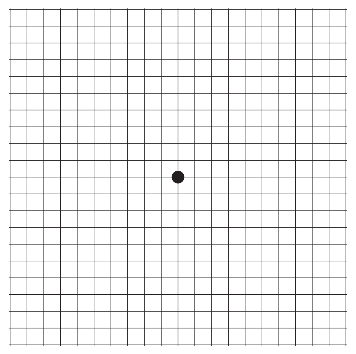Amsler Grid with grid lines to test for vision abnormalities.